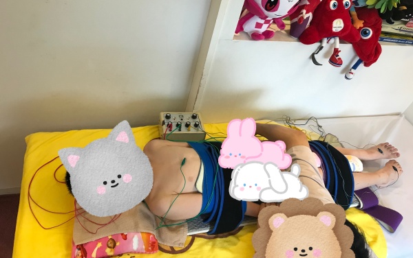 宿泊集中施術の新脳針の写真
